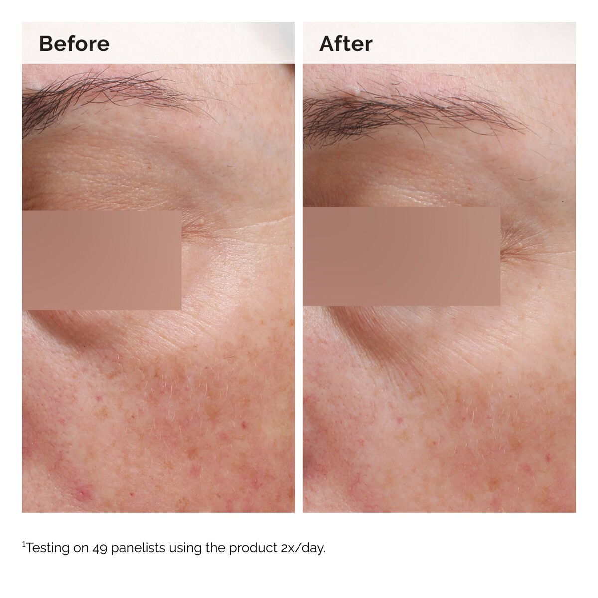 niacinamide-5-face-and-body-emulsion-h8 2024-08-23-ORD-Nia-5pct-Face-Body-B-A-Elasticity-Global-02-1x1.jpg