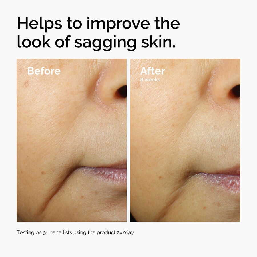 caffeine-3-escin-1-face-serum-i3 ord-caffeine-3pct-escin-1pct-face-serum-before-after-sagging.jpg