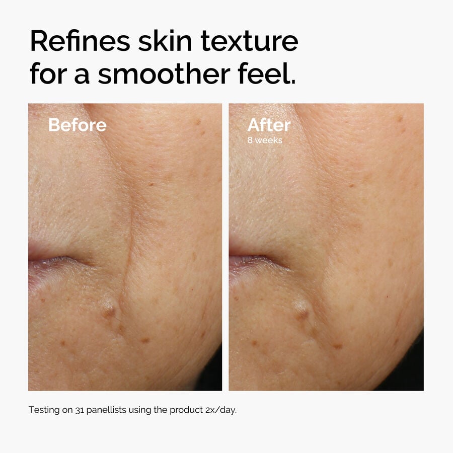 caffeine-3-escin-1-face-serum-i3 ord-caffeine-3pct-escin-1pct-face-serum-before-after-texture.jpg