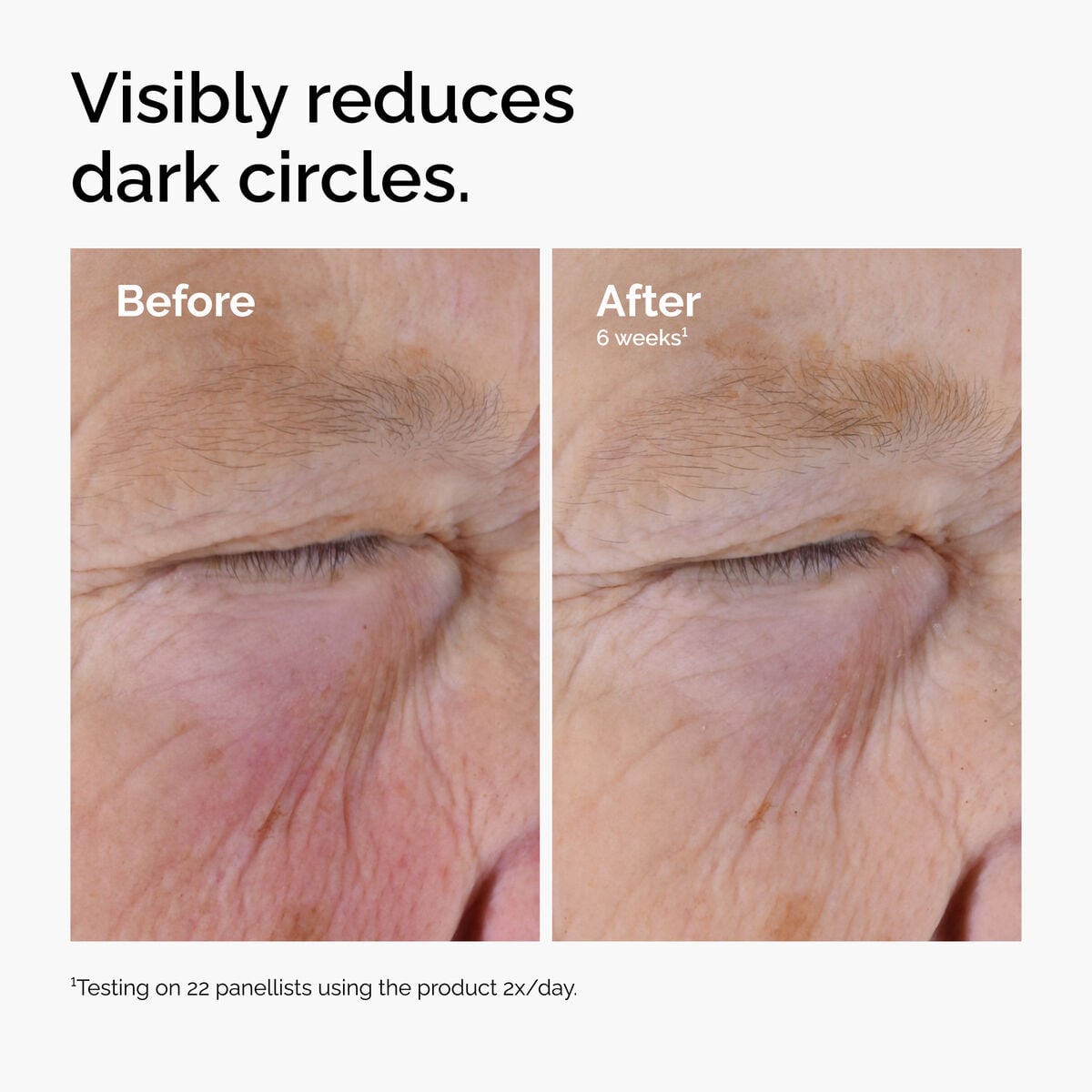 caffeine-solution-5-egcg-eye-serum-j3 ord-caffeine-solution-egcg-dark-circles-before-after.jpg