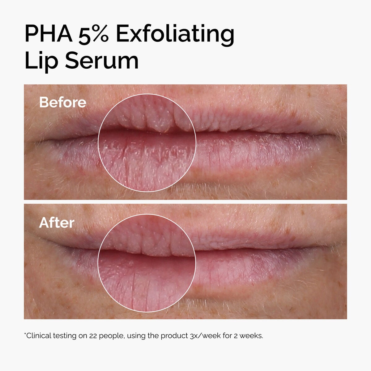 pha-5-exfoliating-lip-serum-e8 ord-pha-5pct-lip-exfoliating-serum-before-after.jpg