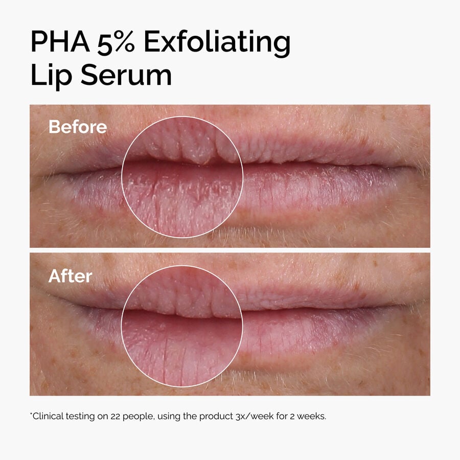 pha-5-exfoliating-lip-serum-e8 ord-pha-5pct-lip-exfoliating-serum-before-after.jpg